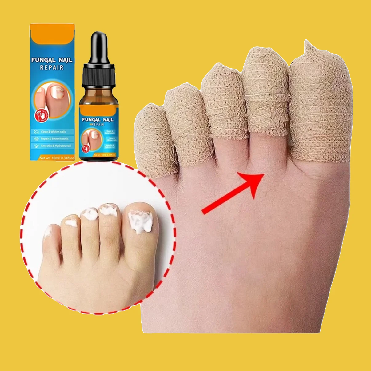 

Масло грибка ногтей, покрытие для ногтей, защита пальцев, защита ног и пальцев, самоклеящаяся повязка, защита пальцев и пальцев, 10 мл