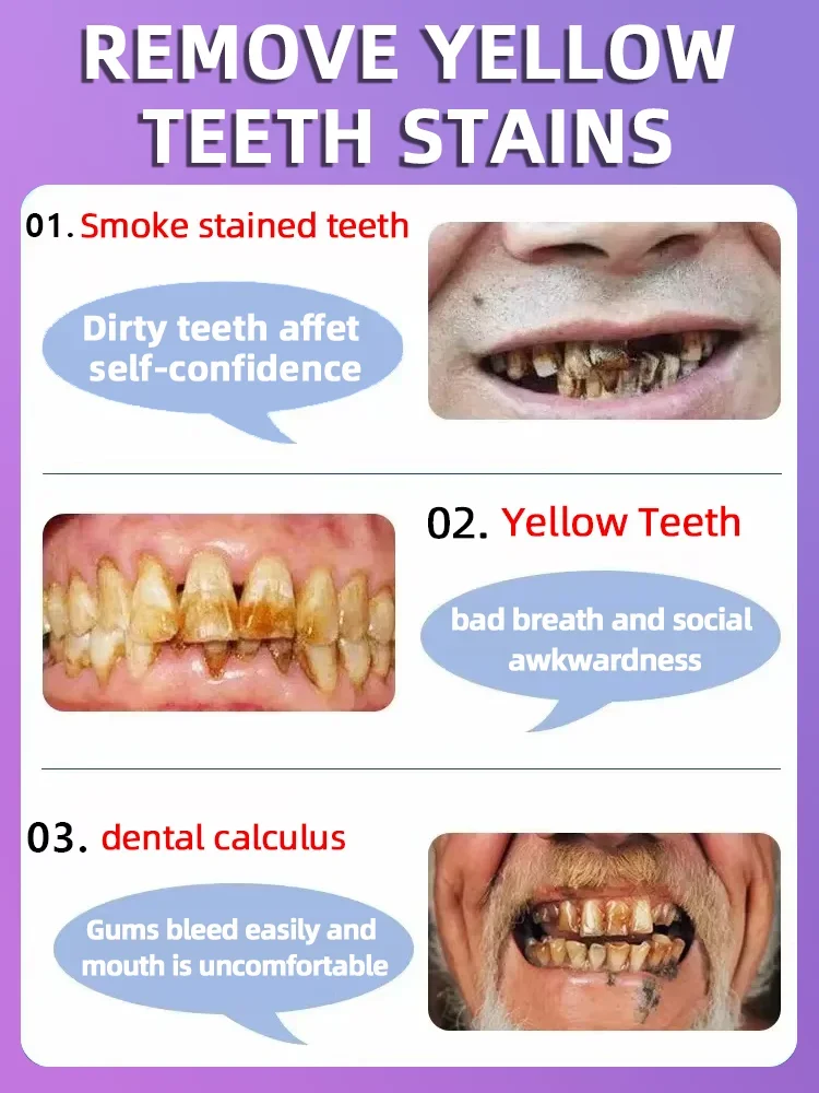 About how to resolve the decay teeth， this product can give you a good answer