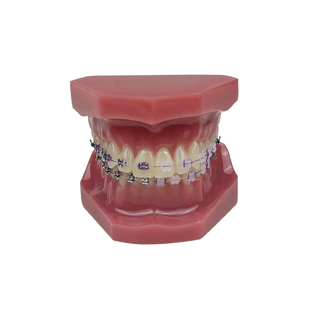 Orthodontic Dental Treatment Teeth Model Teaching Study Gum Tooth Models With Ortho Metal Bracket Arch Wire Ligature Ties Dentis