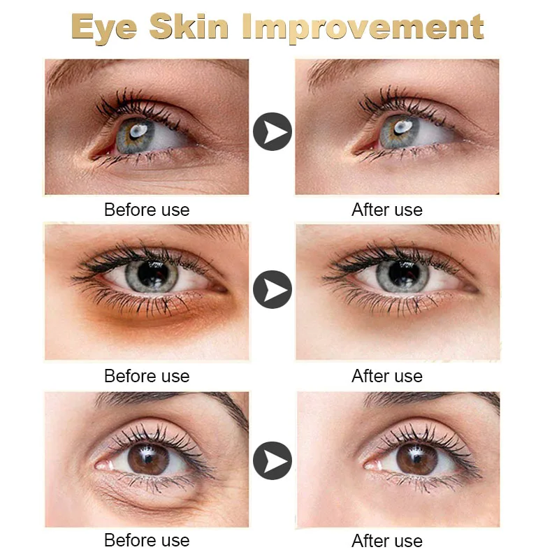 Anti-Wrinkle Eye Cream Fade Fine Lines Anti Dark Circle Remove Eye Bag Puffiness Firming Lifting Moisturizing Skin Care Products