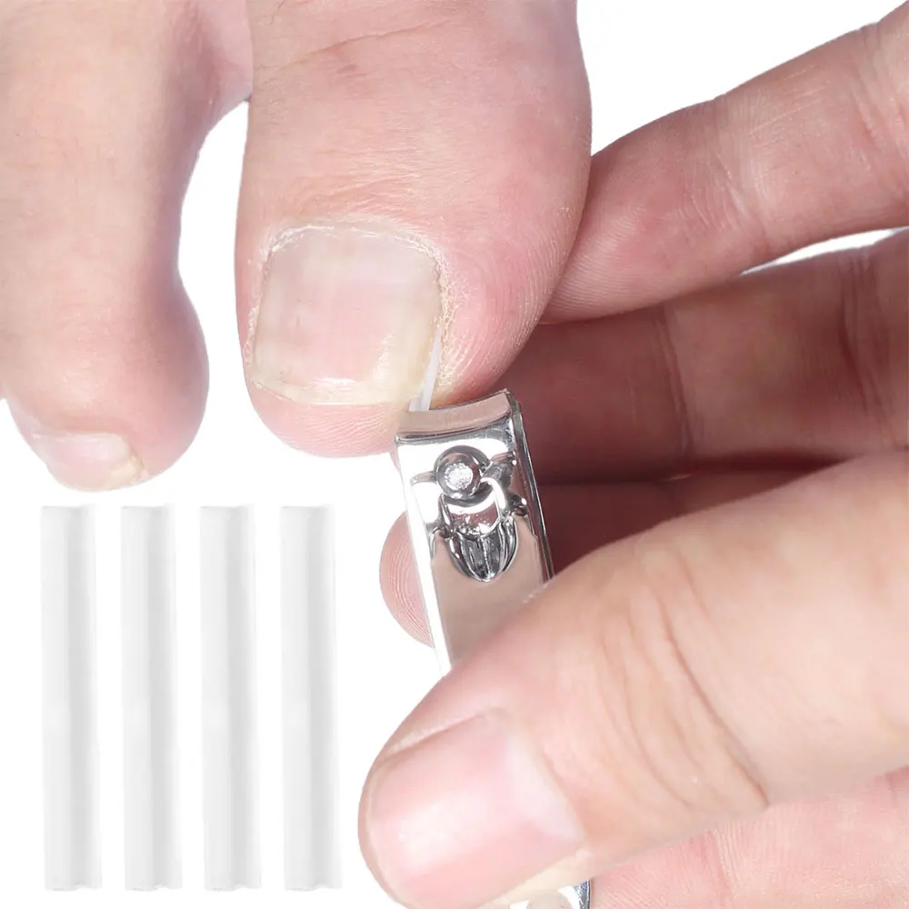 10/12 Uds delineador de corrección de uñas encarnadas herramienta de pedicura tiras alisadoras de uñas en forma de C para hombres mujeres pies cuidado de la salud