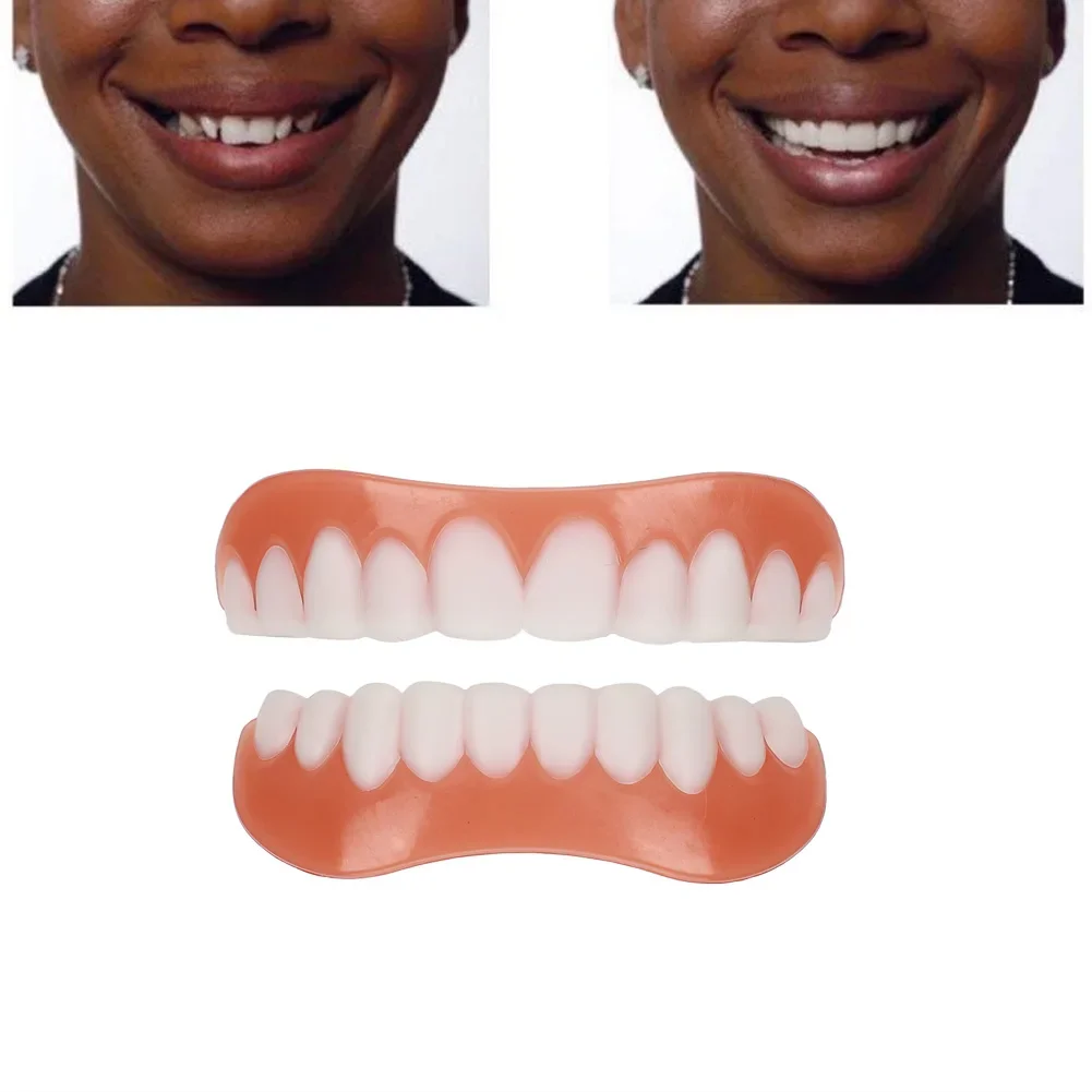 2Set Bretelle imitazione silicone Adesivi sbiancanti per denti superiori e inferiori Impiallacciature professionali per sorriso perfetto Accessorio dentale cosmetico