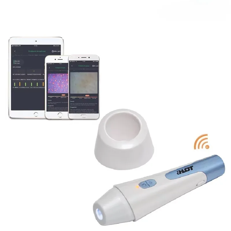 محلل ذكي للوجه وفروة الرأس بالذكاء الاصطناعي - كاشف بصيلات الشعر الذكي مع كاميرا 50X/200X HD، تمكين واي فاي #5