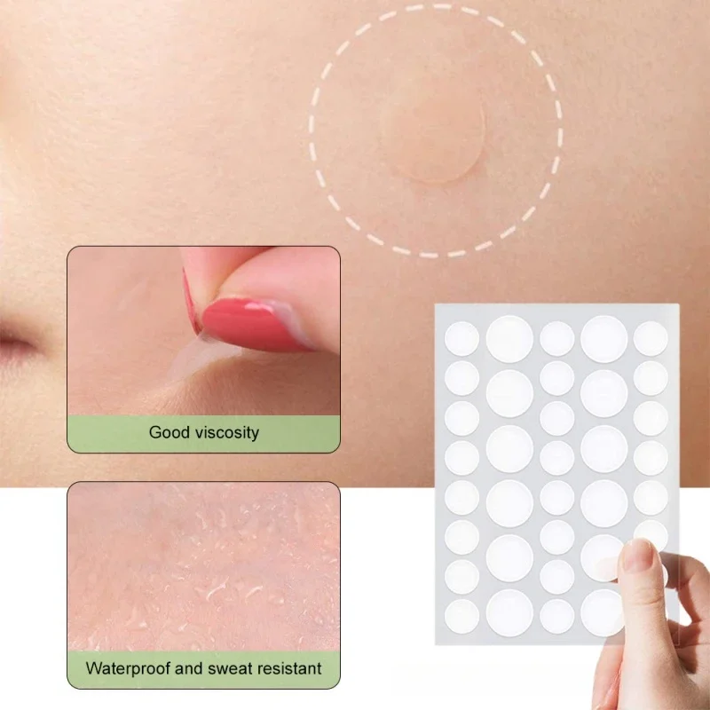 Onzichtbare Acne Patches Verwijderen Puistje Anti-Acne Hydrocolloïde Pleisters Vlekken Markeren Concealer Reparatie Sticker Waterdicht