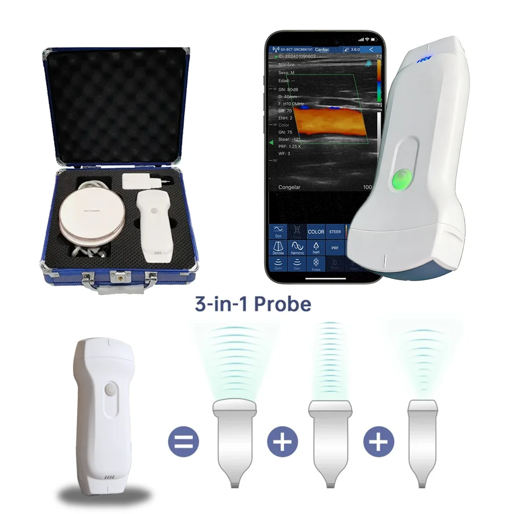 Pet/Animal Multi-platform Supported Ultrasound Scanner Probe Wireless WIFI High Frequency Color Doppler Probe Pocket