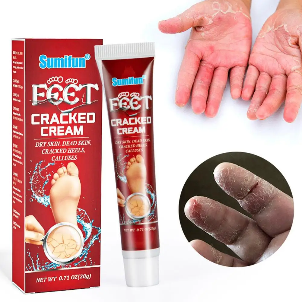 Creme rachado para mãos e pés e pés, rachaduras secas, anticongelante, creme protetor, hidratante, outono, inverno, E1l9