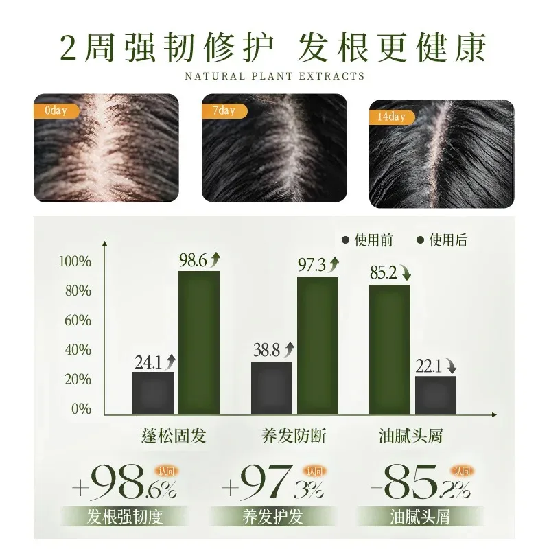 صابون شامبو للتحكم في القشرة مصنوع يدويًا حرفية Cacumen Platycladi شينجيانغ Usma Grass Polygonum Multiflorum صحة فروة الرأس #5