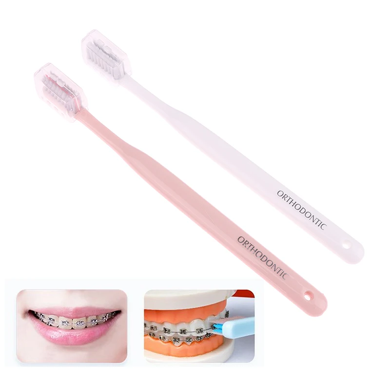 1Pc Schoon Orthodontische Beugels Volwassen Orthodontische Tandenborstels Dentand Borstel Zachte Borstelharen Tandenborstel Voor Mondzorg