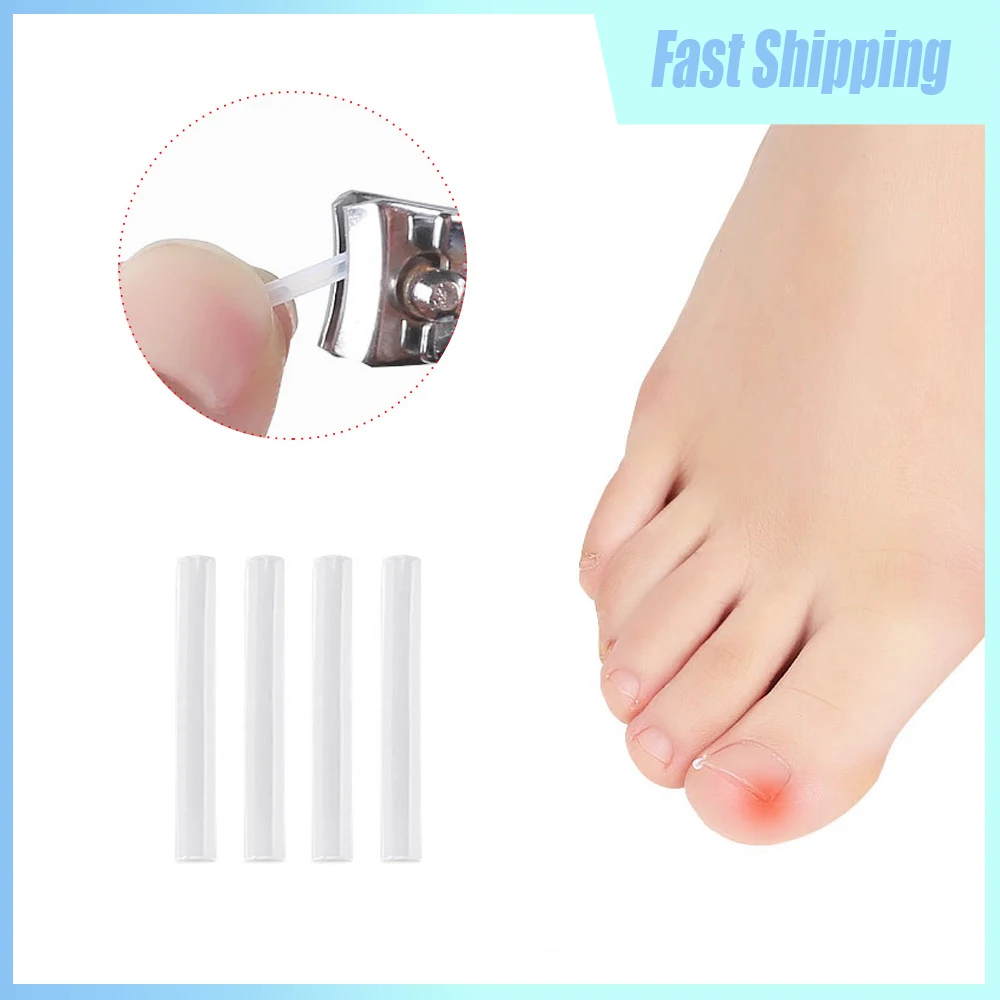 50pcs Household Toenail Correction Pad Disposable Toenail Ingrown Correction Tool Nail Treatment Correction Filler Strip