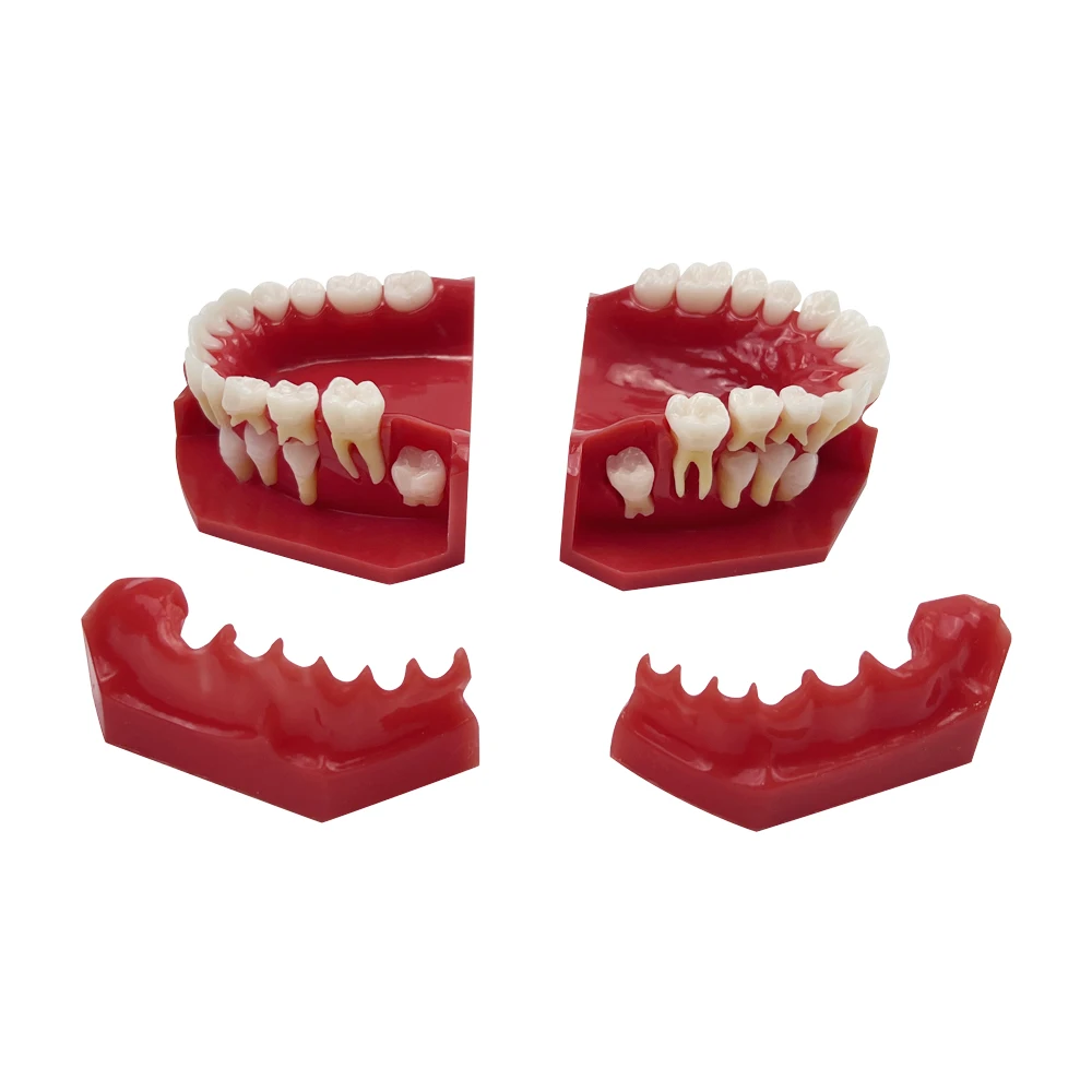 Dental Model Resin Children Primary Permanent Tooth Model Alternative Deciduous Teeth Model For Studying Teaching  Demonstration