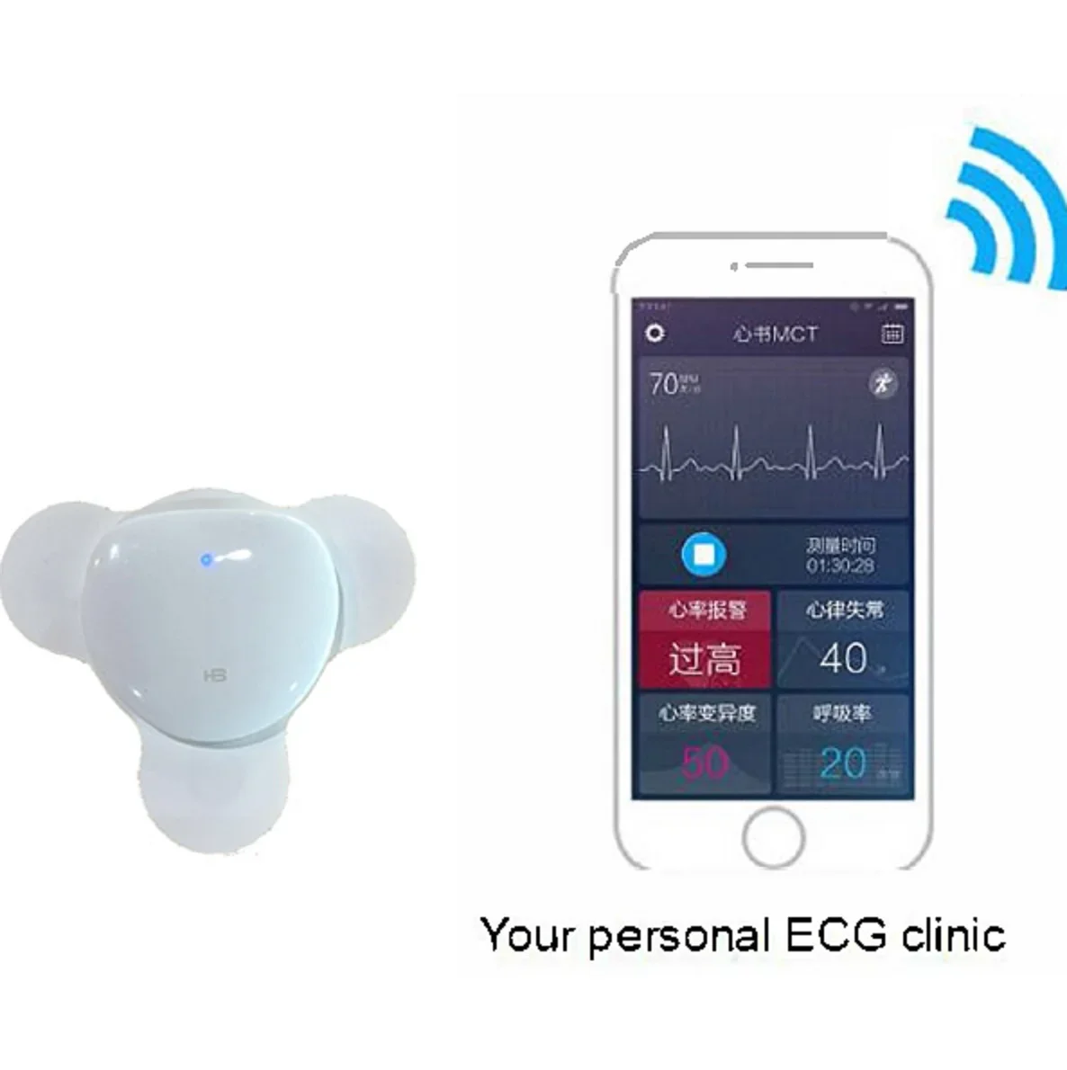 Máy Đo Nhịp Tim Di Động Điện Tâm Đồ Cầm Tay Điện Tâm Đồ Dán Cường Lực Holter Điện Tâm Đồ Cho Từ Xa