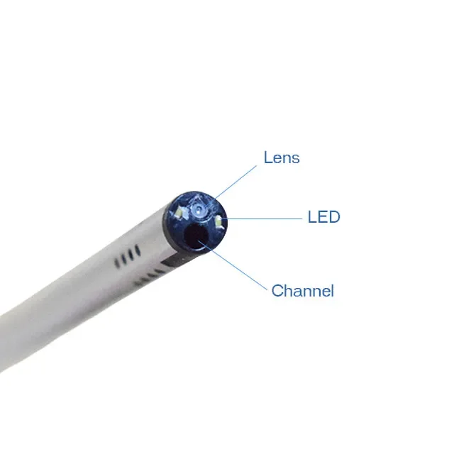 Dispsosable Hysteroscope 2.0mm Working Channel Electronic Single-use Hysteroscope Operative Endoscope