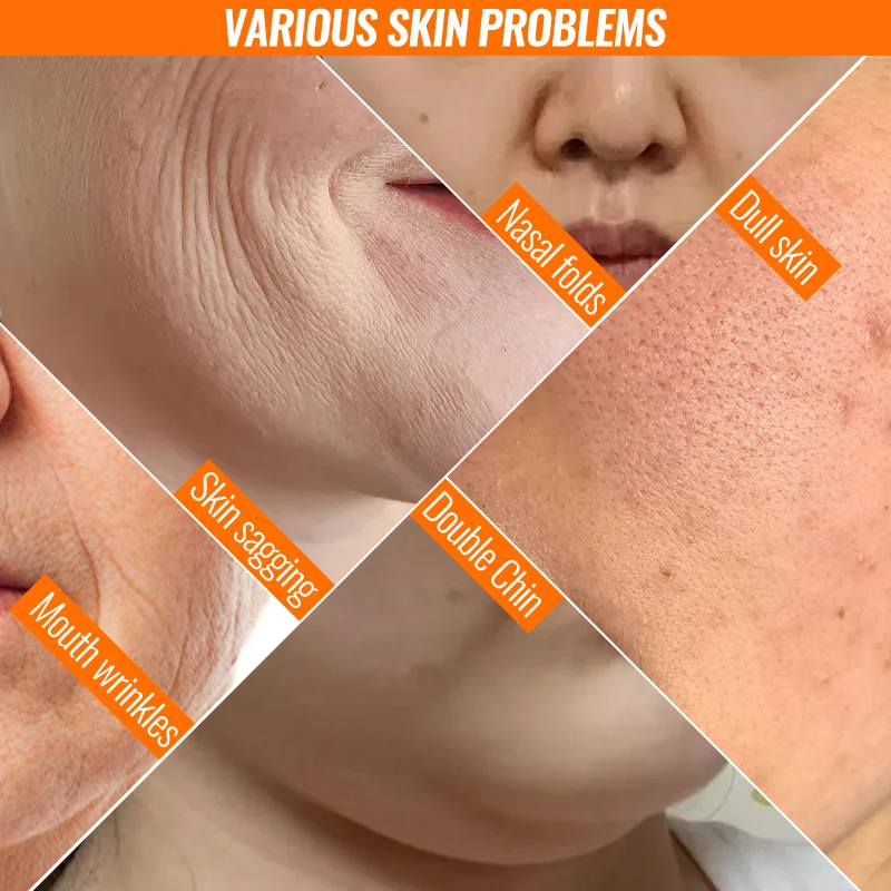 ポータブルハイフ超音波しわ除去アンチエイジングフェイスリフティング肌引き締め再生アイケアサロンホーム美容機器