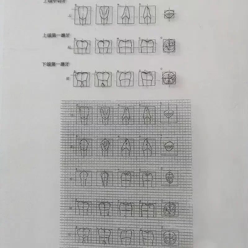 Dental Materials Dental Relief Drawings Line Drawings Three Standard Dental Carving Comparison Transparent Drawings Oral Tools