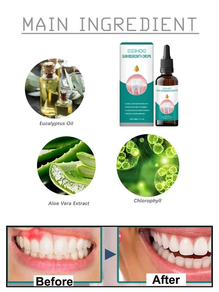 Rapid Repair Gums Serum Effectively Relieve Tooth Allergy Dental Caries Tooth Cleaning Toothpaste Relieve Tooth Damage Drops