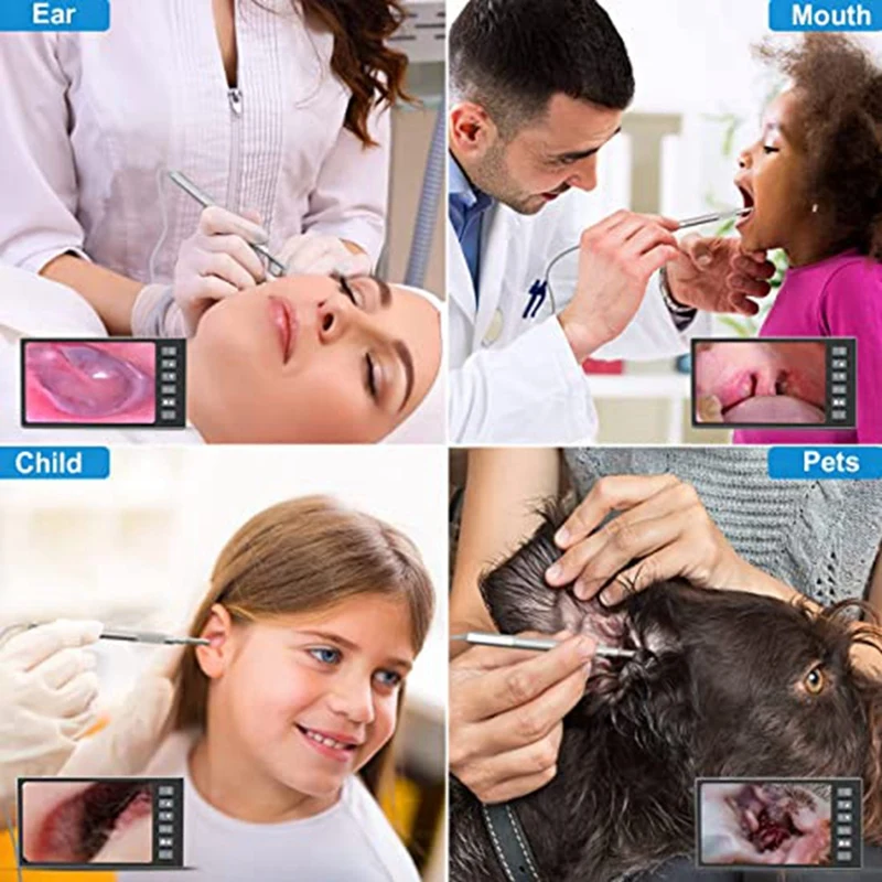 Digital Otoscope Set Kit With 7-Inch Screen Ear Camera Kit Visual Ear Scoop Supports Photo Snapshots And Video Recording