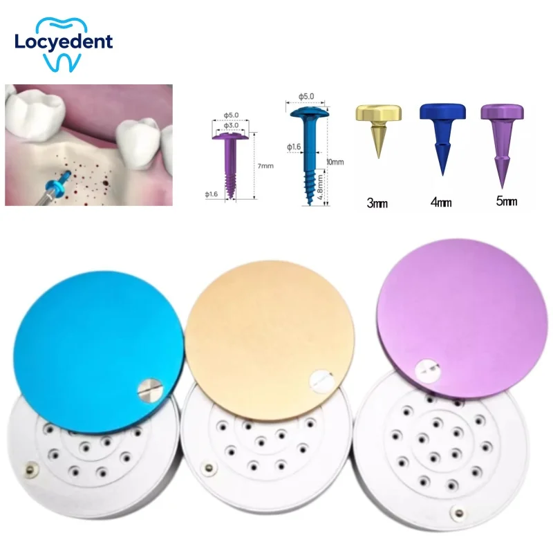 

Titanium Fixation Screws for GBR Surgery, Non-Absorbable Locating Nails to Secure Bone Graft Membrane & Titanium Mesh