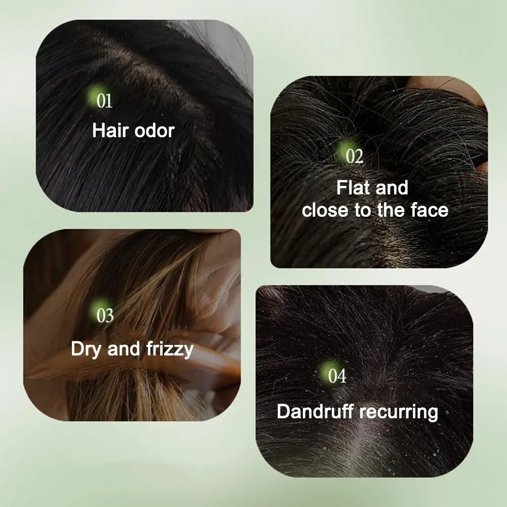 1/2/3pcs Hair Loss Prevention Set Fast Regrowth Hair Essential Oil Usman Handmade Shampoo Soap Hair Care Serum Scalp Thickening view 5