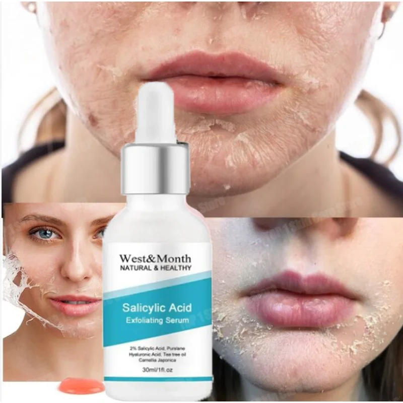 Salicylic Acid Exfoliating Serum Anti Aging Essential Oil Shrink Pores Remove Acne 30ml Exfoliants  Face Peeling Gel Emulsions