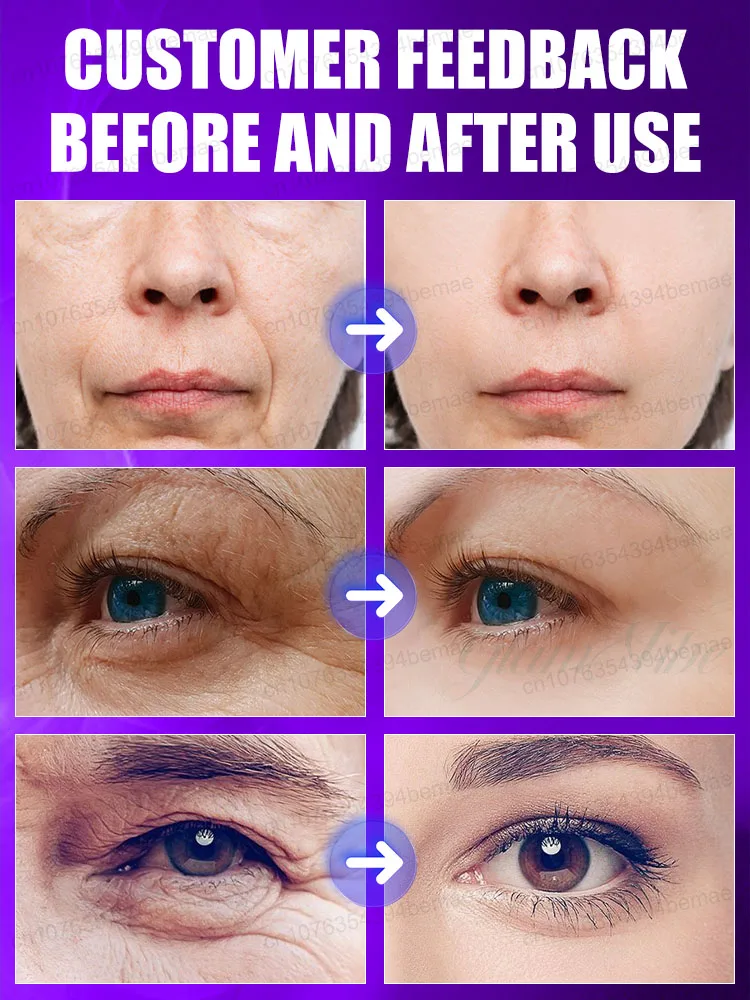 Say goodbye to wrinkles