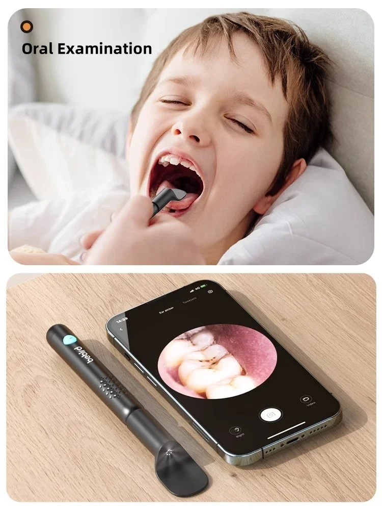 Ear Cleaner Bebird R3 Smart Visual Ear Sticks Endoscope 300W High Precision Earpick Mini Camera Otoscope Personal Health Care
