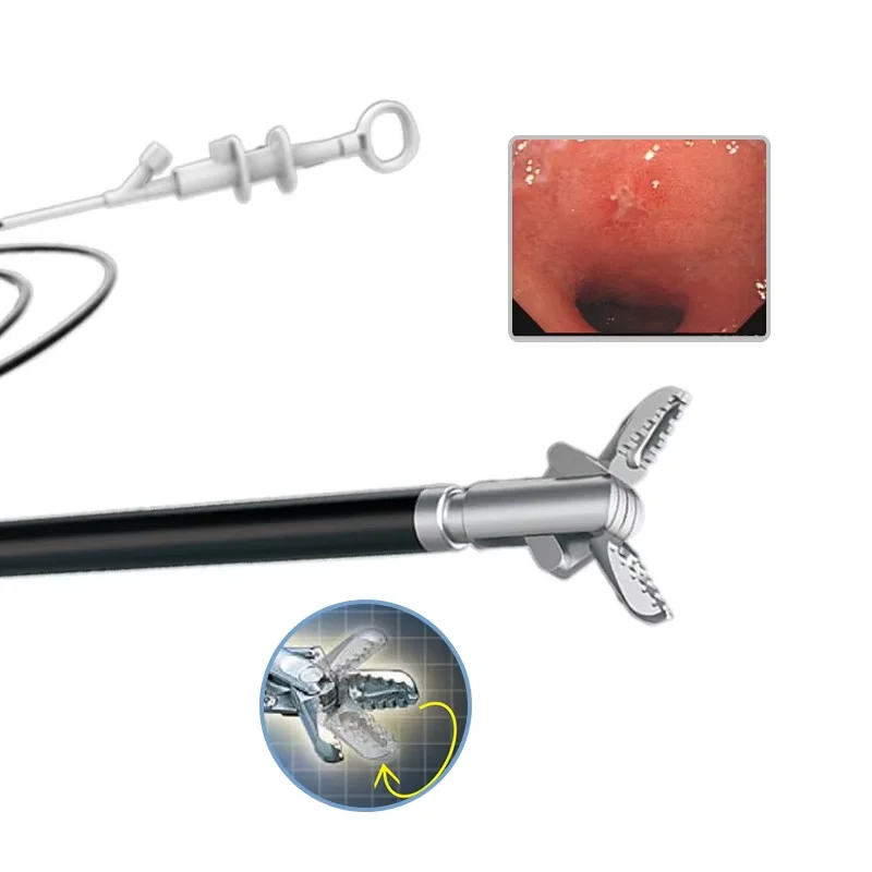 Single‑Use Punch  Forceps Flexible Disposable  Forceps for Endoscopy and Colonoscopy