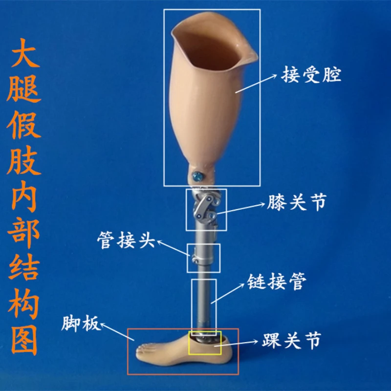 Stainless Steel Thigh Prosthesis Thigh a Prosthesis Prosthesis Customization Products