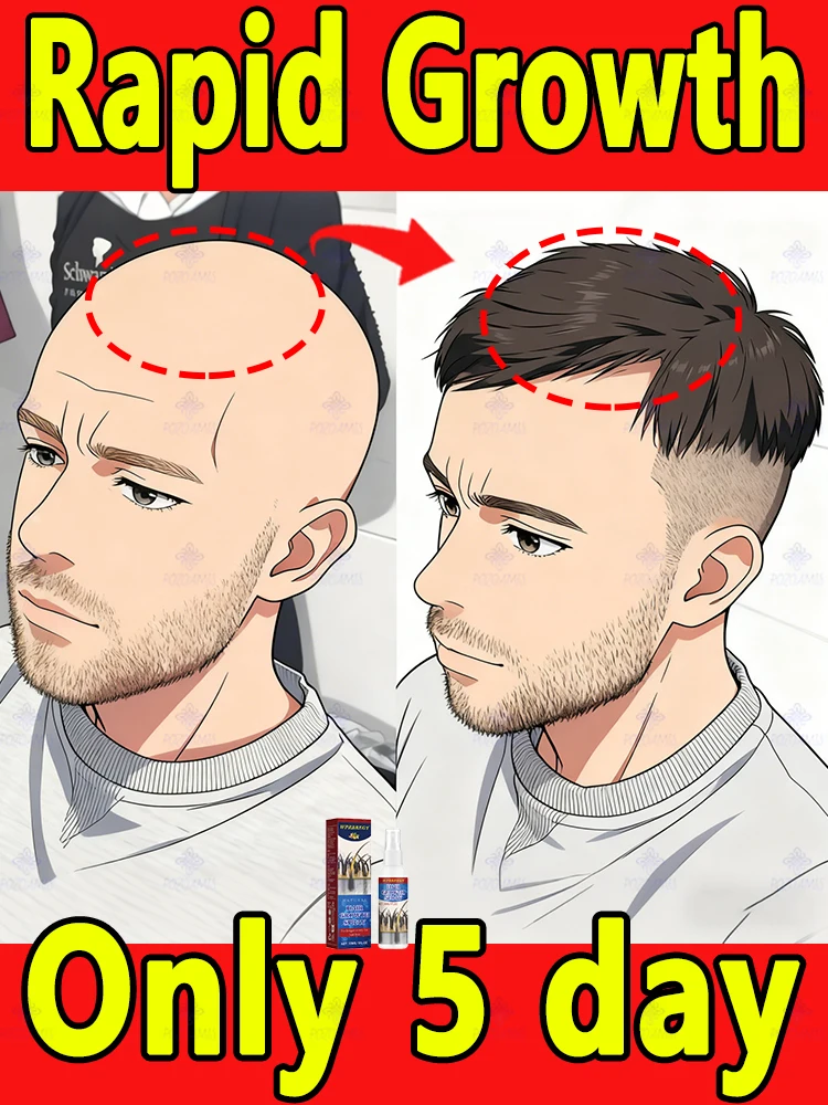 

The ultimate hack for less visible scalp