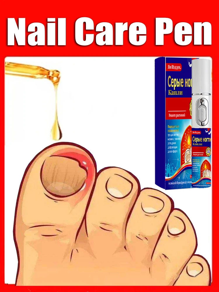 

Fungal Nail Laser Device