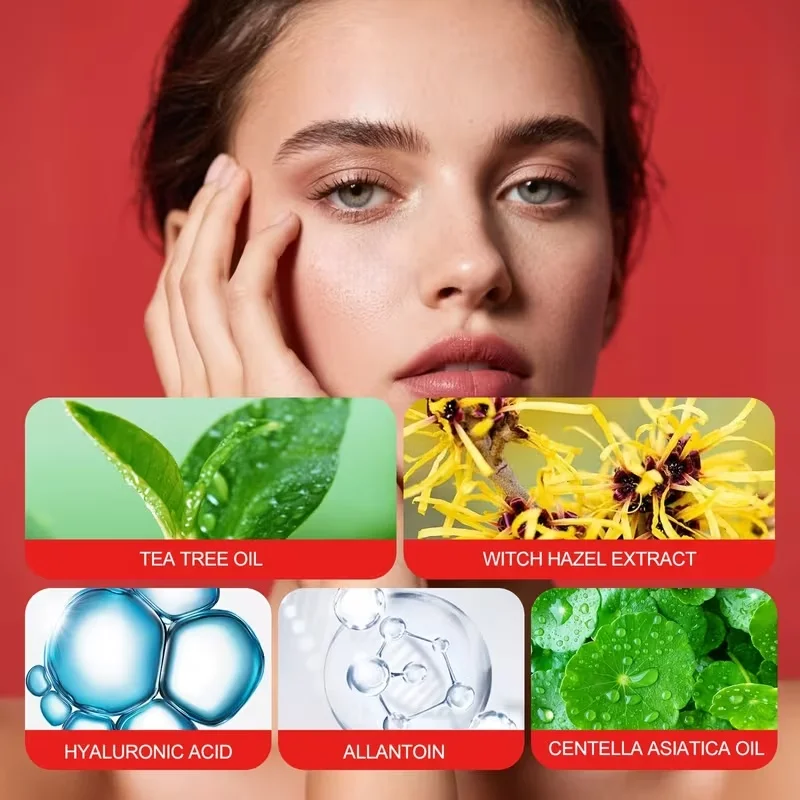 36 round acne patches with skin tone, water-based gel acne patches, ultra-thin and easy to tear