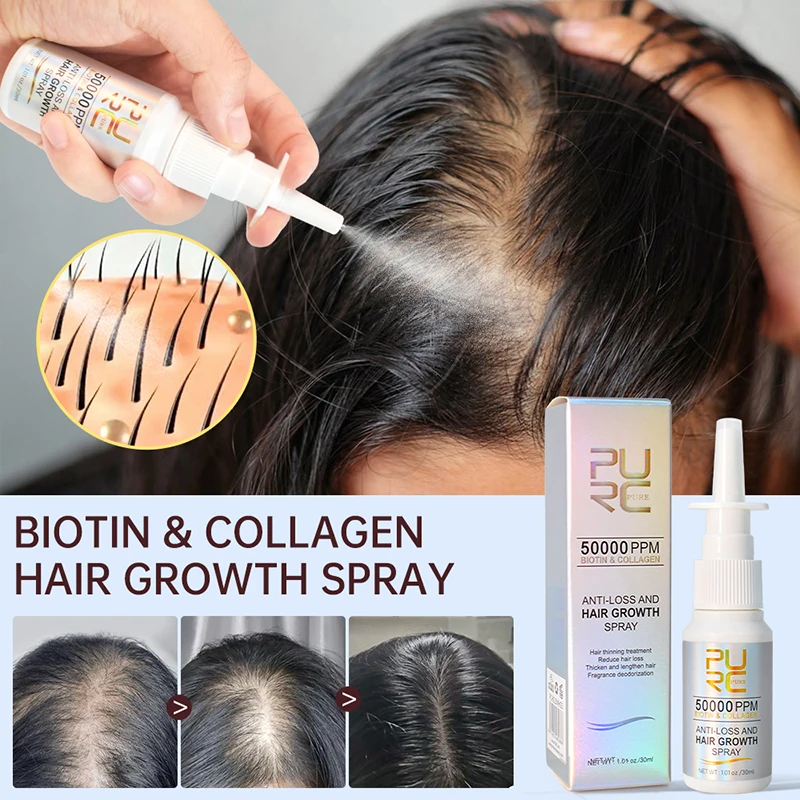 Productos de Biotin para el crecimiento del cabello para hombres y mujeres, tratamiento para la caída del cabello, Spray de crecimiento rápido, aceite espeso, cuidado, mejora la costura del cabello