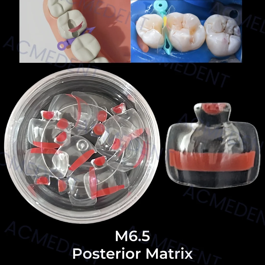 M6.5 Dental Posterior Matrix Transparent Clear Matrix BT Bow Maxillary Matrices Contoured Fit BioClear Matrice Black Triangle