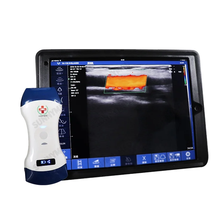 

SY-AC51 medical equipment ultrasound probe wireless ultrasound scanner for sale