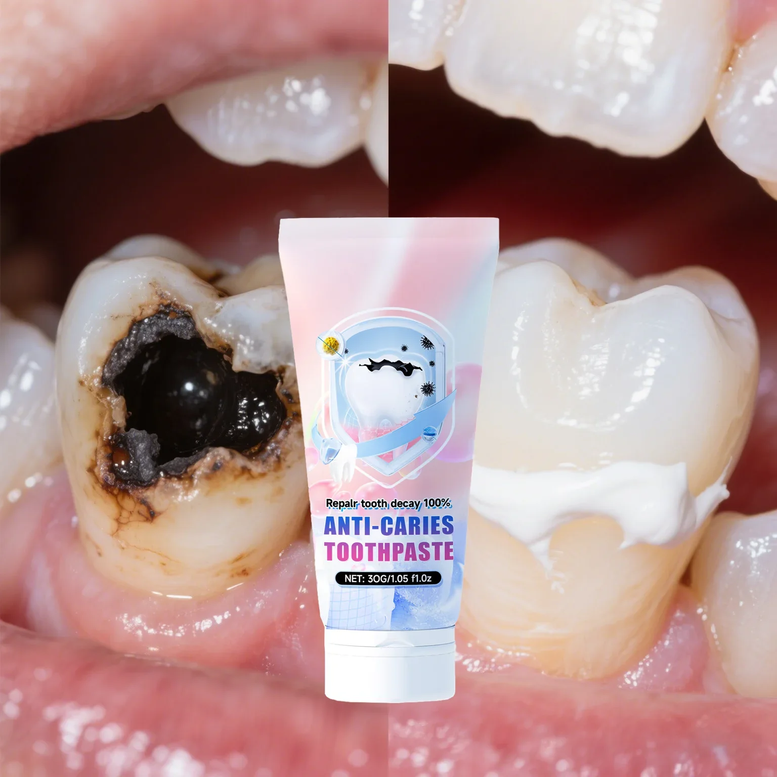

Repair teeth, prevent tooth decay, and effectively remove dental plaque