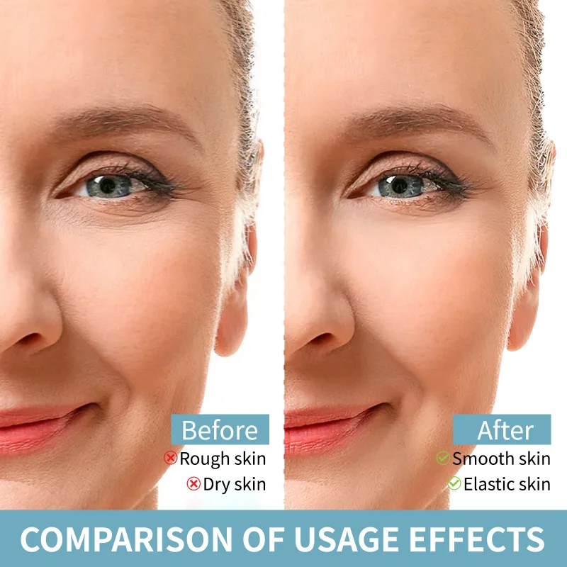 Esfoliante Essência Hidratante Hidratante Esfolia, fornece hidratação e desperta vitalidade da pele