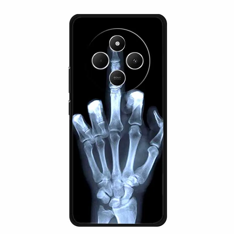 For Xiaomi Poco C75 Case C 75 Phone Cover Lion Wolf Black Silicone Soft Back Cover Case For Poco C75 Case POCOC75 6.88\