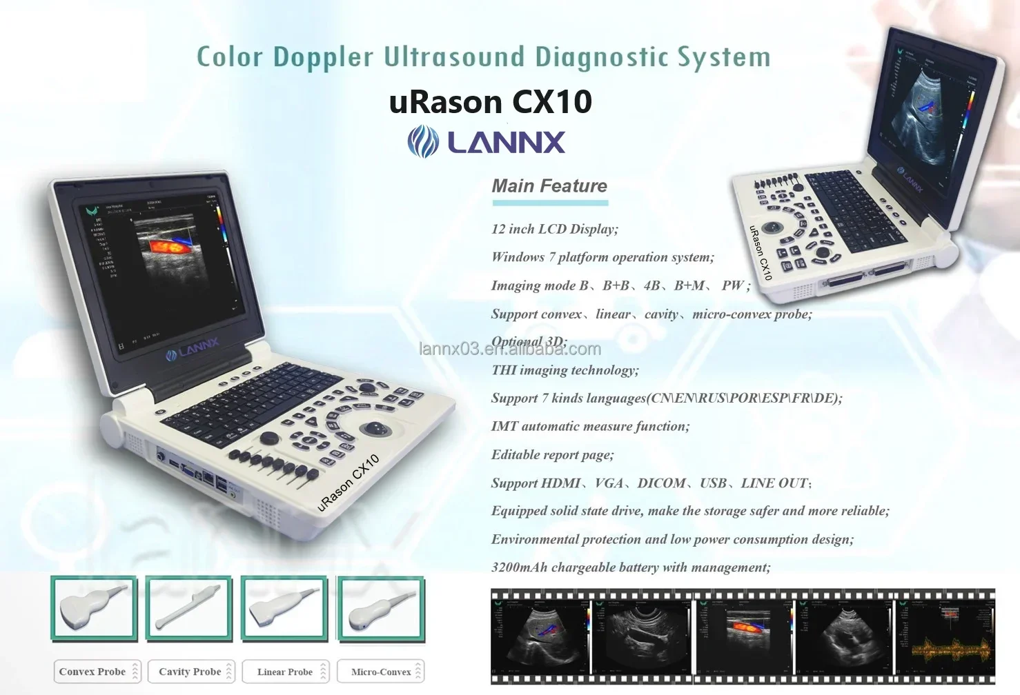 LANNX uRason CX10 Ecografo Digital Cardiac Ultrasound Machine Color Doppler ultrasonography Scanner Medical Echo Ultrasound