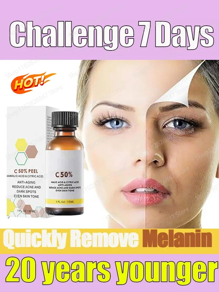 High Quality 50% Chemical Exfoliating Peel Tca Peel Acid Skin Superforce Pigmentation Lightening Melanin Acne Beauty care