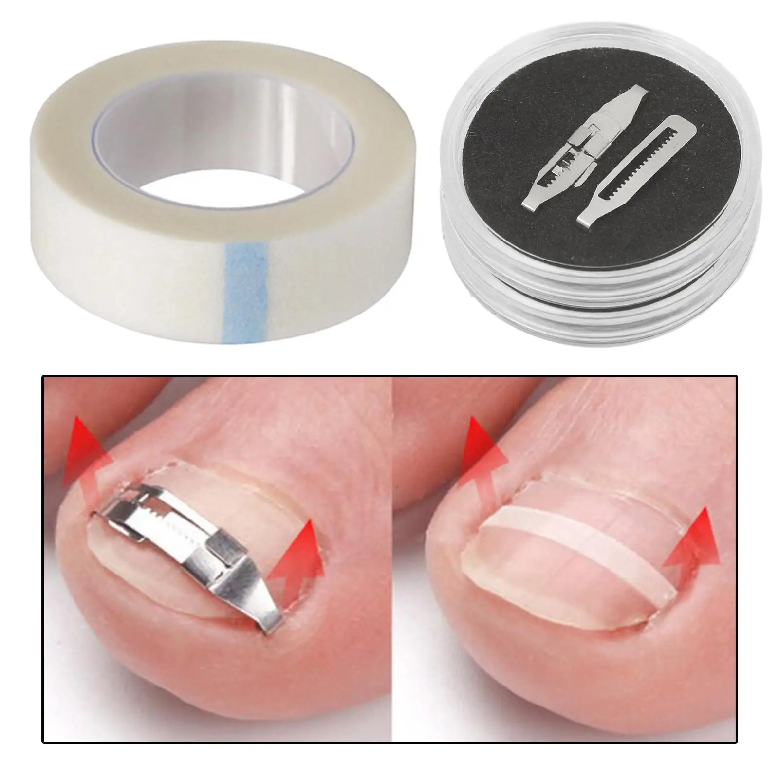 أدوات مصحح أظافر القدم الغارزة المهنية تضمين علاج أظافر القدم