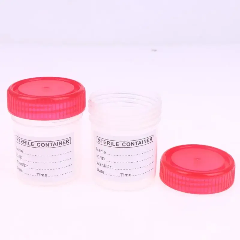 10 Uds. Contenedor de vaso de plástico de 60ML, recipiente desechable para colección de orina, recipiente para botella de muestra con etiquetas
