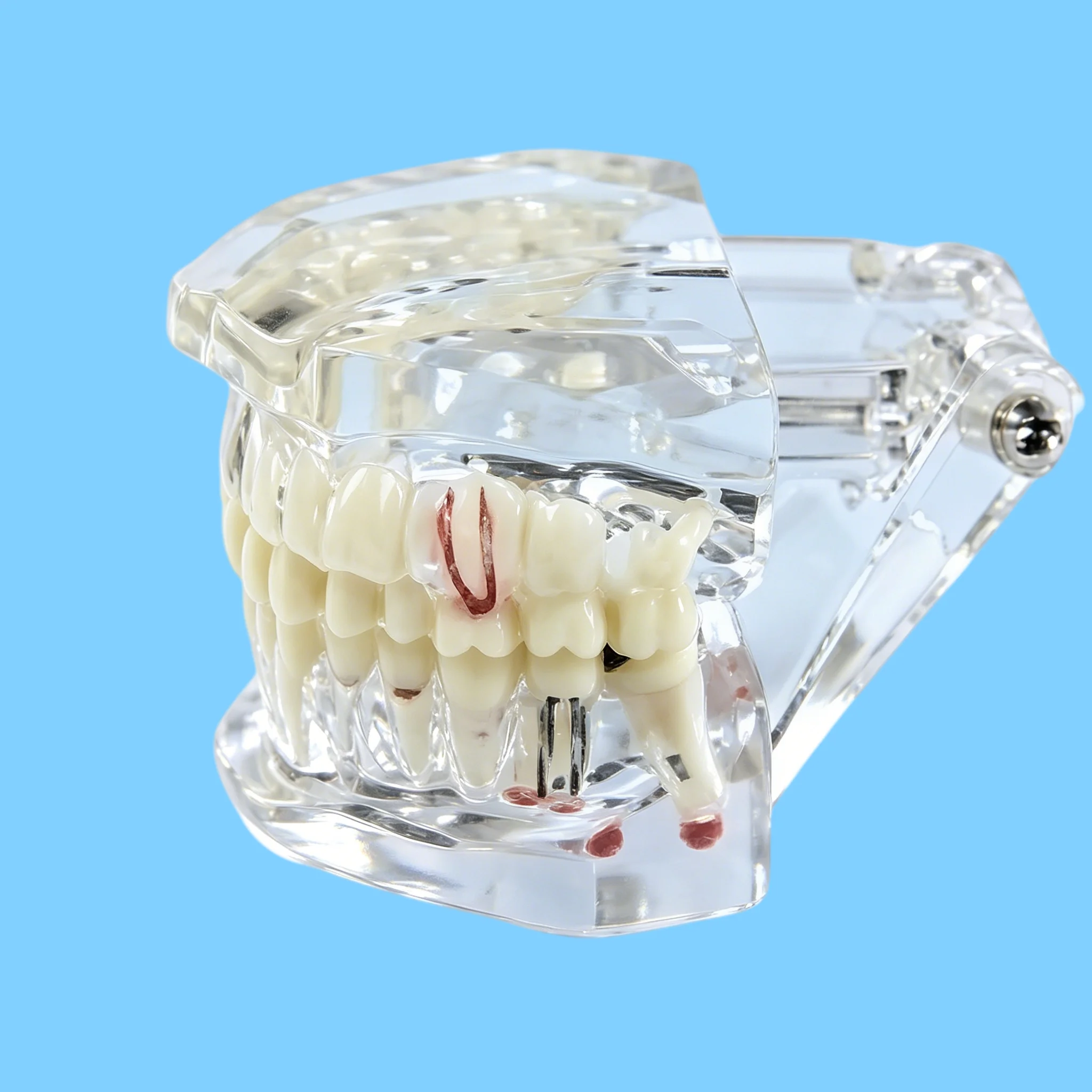 Multi Color Dental Pathology Model, Dental Teaching Model, Orthodontic Removable Denture Implant Model, Dental Materials
