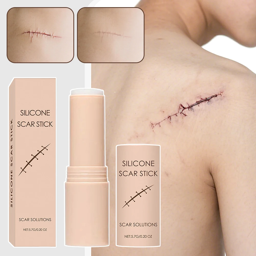 

Силиконовые палочки для шрамов Нежный безопасный для всех типов кожи Для ежедневного использования
