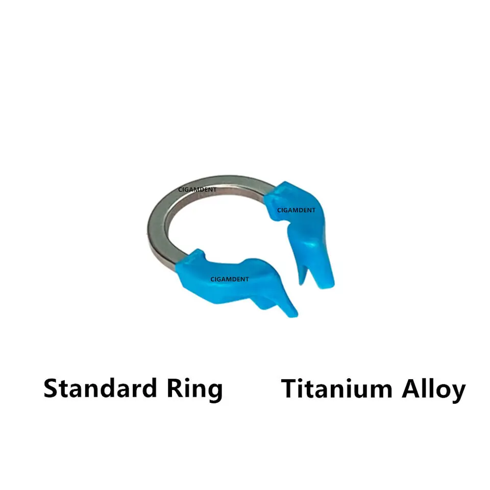 Matryce dentystyczne opaski z wyciętym systemem matryc matryc metalowych zacisk niklowo-tytanowy pierścień zaciskowy narzędzia dentystyczne