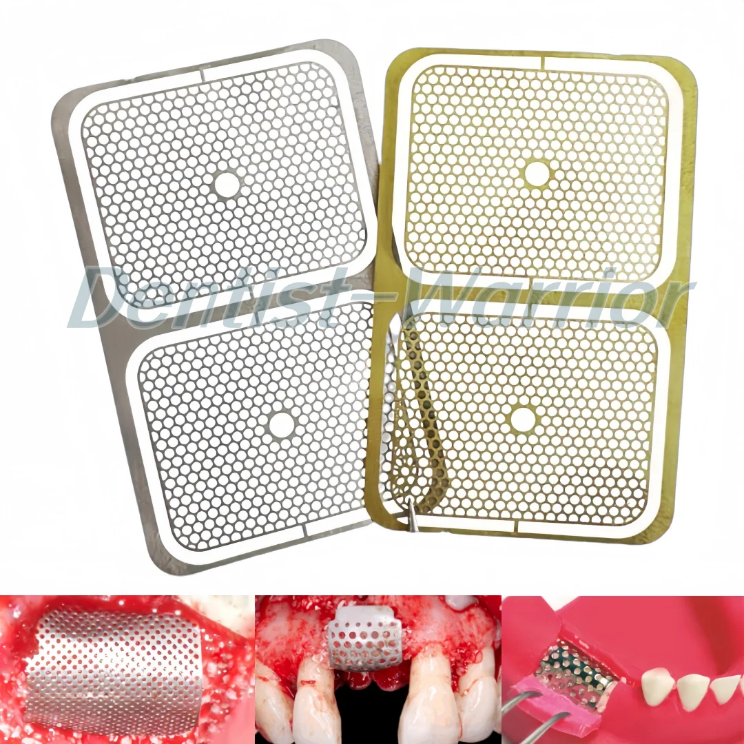 

2-in-1 Dental GBR Flexible Safety Titanium Mesh 20x25mm Barrier Regeneration Mesh Films Gold/Silver