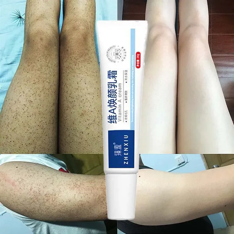 Krim Pemutih Tubuh, perawatan kulit kering, penghilang kaki stroberi, perbaikan folikel ayam kasar, pengobatan Keratosis Pilaris, Krim Pemutih Tubuh