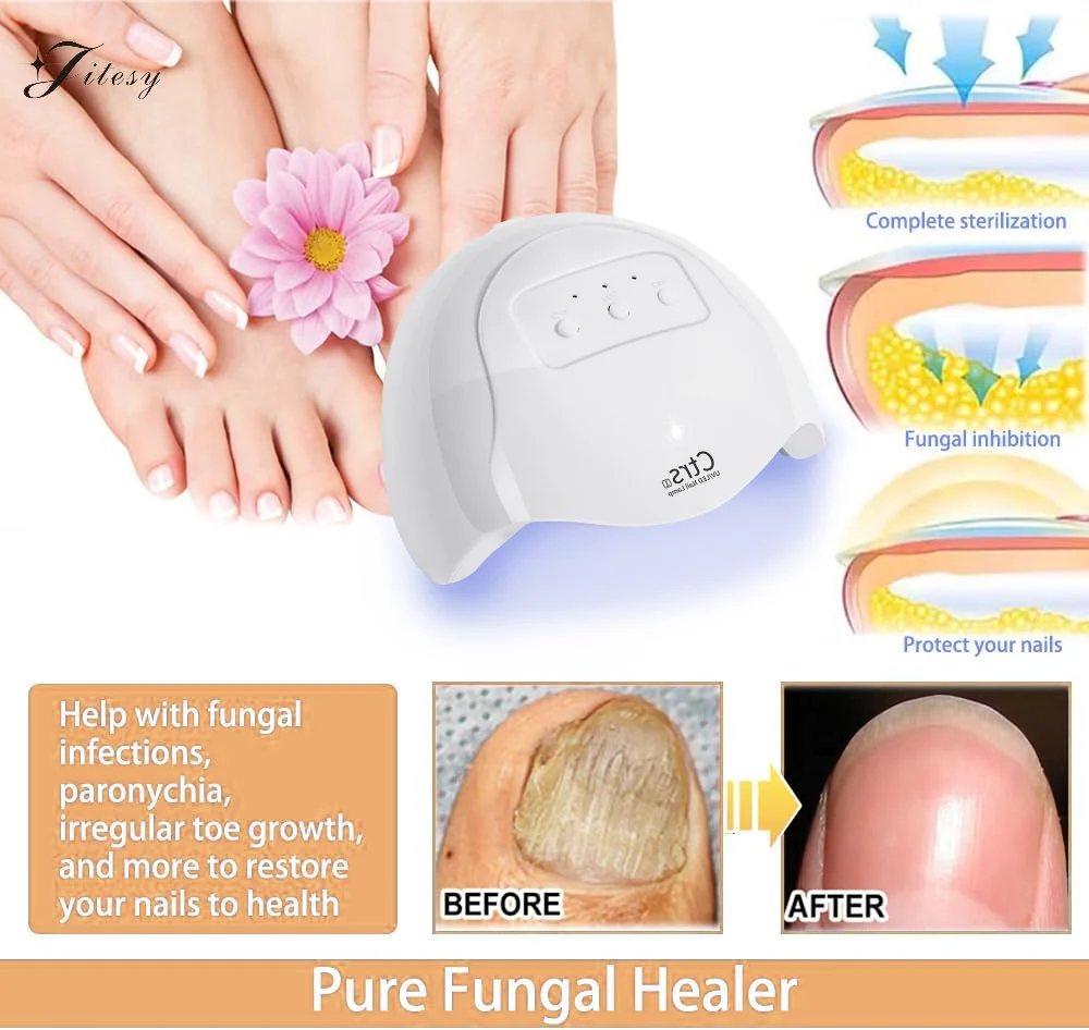 Nail Fungus Laser Device Fungal Nail Treatment Repair Onychomycosis 470nm UV Light 905nm Infrared Light Nail Fungus Treatment