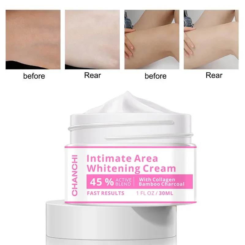 Intimate Area Whitening Cream Underarm Elbow Buttock Private Bleaching Remove Melanin Dull Moisturizing Brighten Body Skin Care