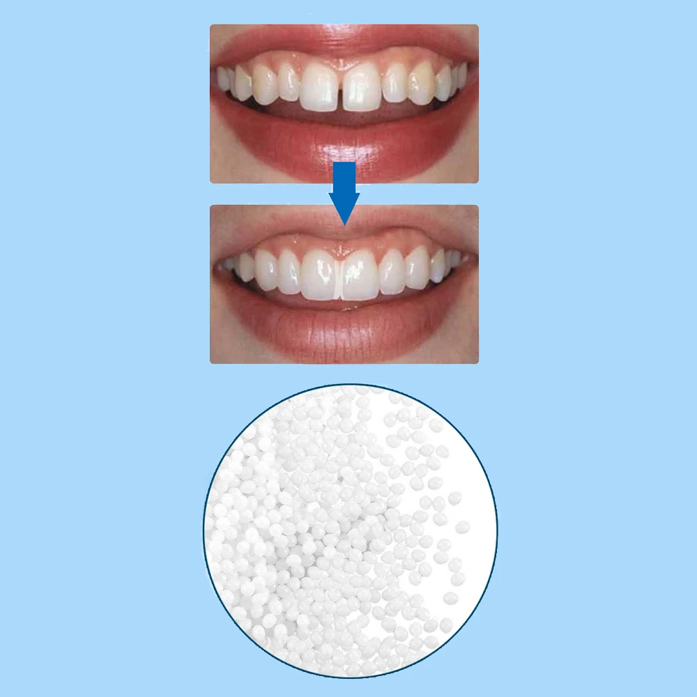 30ml Resin Tooth Repair Glue Shapeable Teeth Gaps Filling Solid Glue Temporary Falseteeth Broken Teeth Repair Glue Dental Care