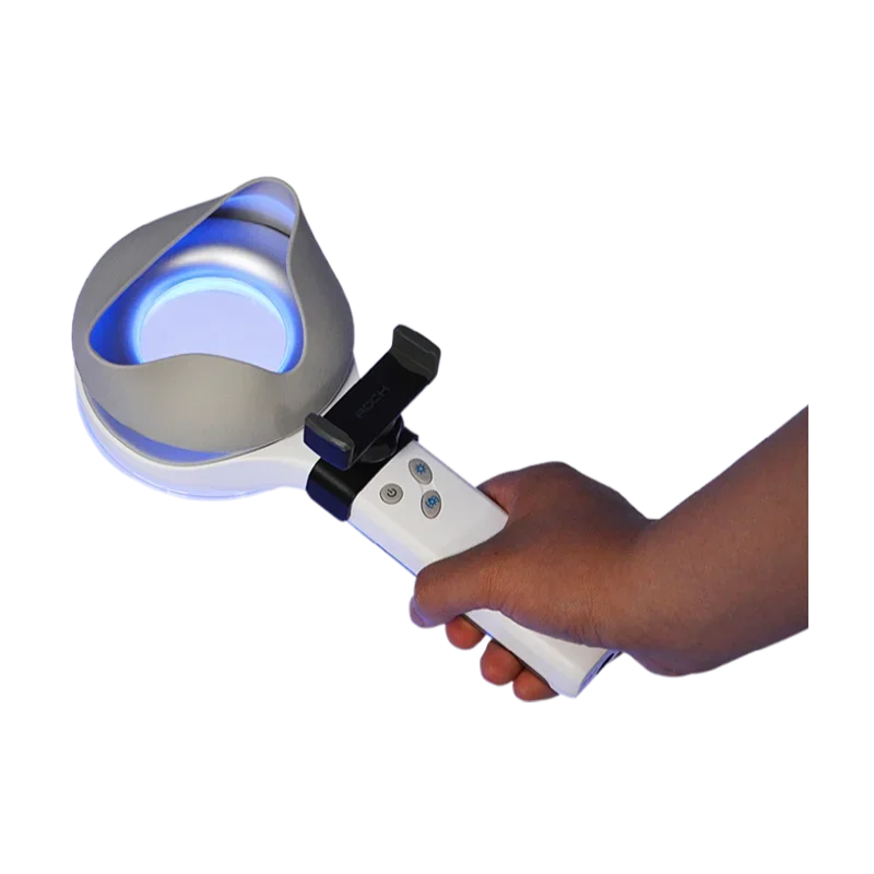 Photodiagnosis System  Analysis Dermatology Dermoscopy Wood's Lamp for Vitiligo Detection Observation