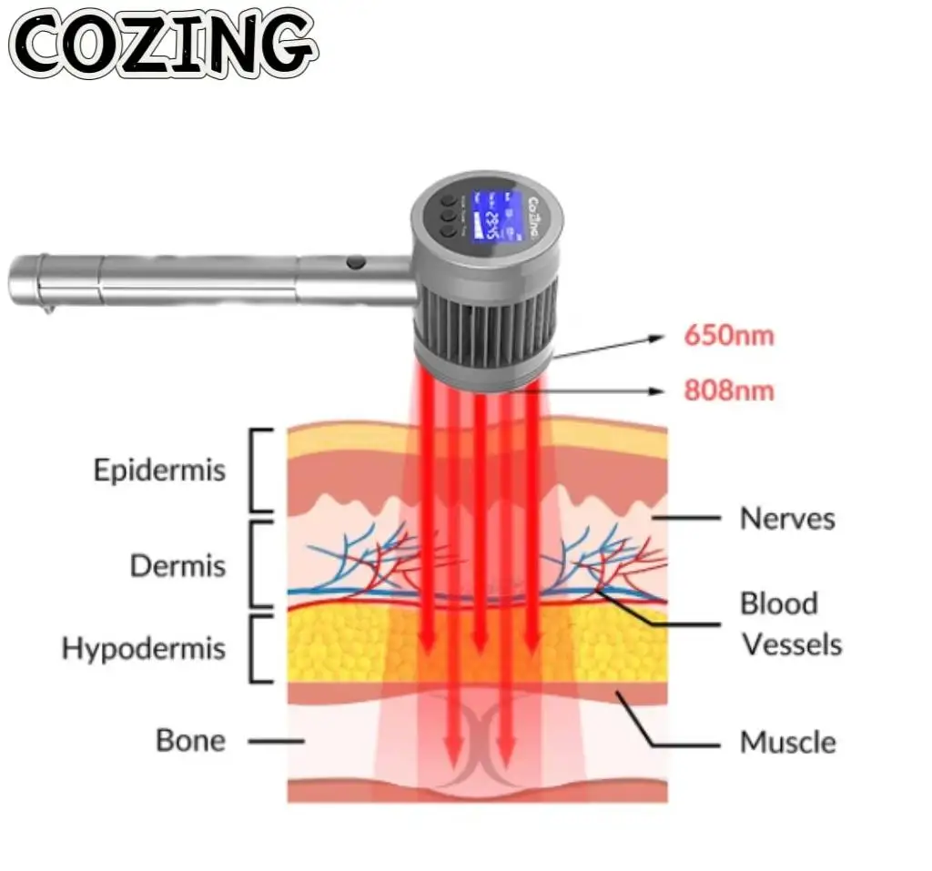 

Портативный лазерный терапевтический аппарат COZING 808 нм 650 нм — для лечения боли в суставах, артрита и физиотерапии мышц